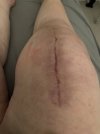 [Bonesmart.org] Just curious