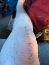 [Bonesmart.org] Update