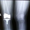 [Bonesmart.org] TRKR 10/13/23 - Moving Forward with Many Detours
