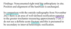 [Bonesmart.org] Heterotopic ossification, not what I expected