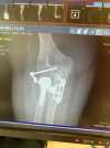[Bonesmart.org] Returning to BoneSmart