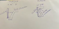 [Bonesmart.org] TKR with Fibro and Raynauds and RA, anyone else?