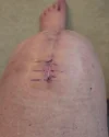 [Bonesmart.org] Just curious