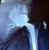 [Bonesmart.org] I am the Storm