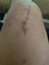 [Bonesmart.org] Just curious