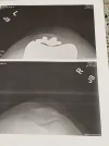 [Bonesmart.org] Partial Revision Failure