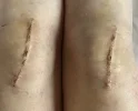 [Bonesmart.org] On the other side