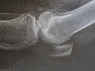 [Bonesmart.org] Moving forward.