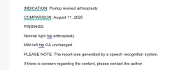 [Bonesmart.org] Heterotopic ossification, not what I expected