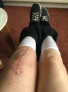 [Bonesmart.org] Reassurance needed