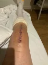 [Bonesmart.org] Reassurance needed