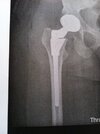 [Bonesmart.org] A Bionic Octopus!