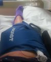 [Bonesmart.org] my knee on the other side