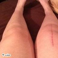 lovemynewknee?