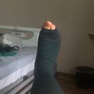 Knockknee8